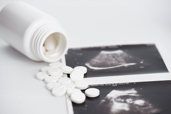 Ultrasound image used to illustrate pregnancy evaluation in the context of abortion pill treatment.