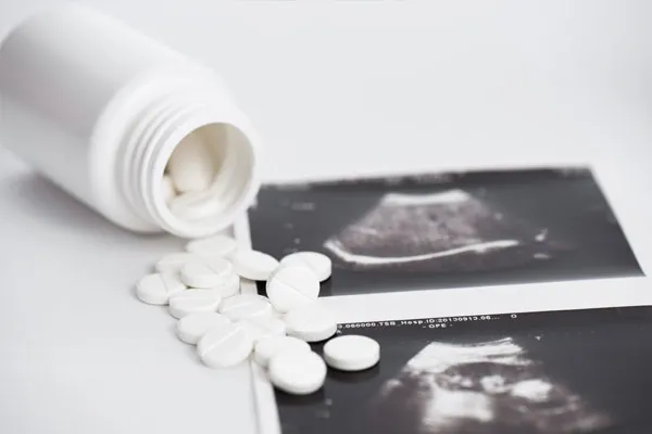 Ultrasound image used to illustrate pregnancy evaluation in the context of abortion pill treatment.